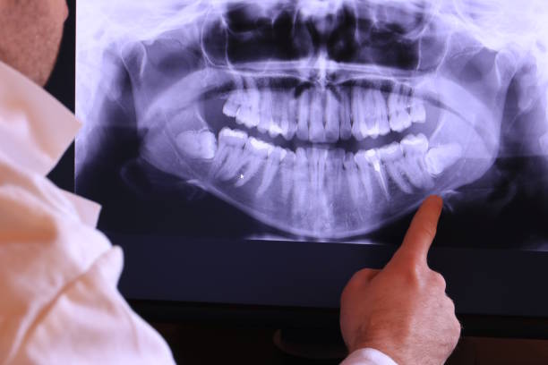 Best Emergency Dental Care for Broken or Chipped Teeth in Enon, VA