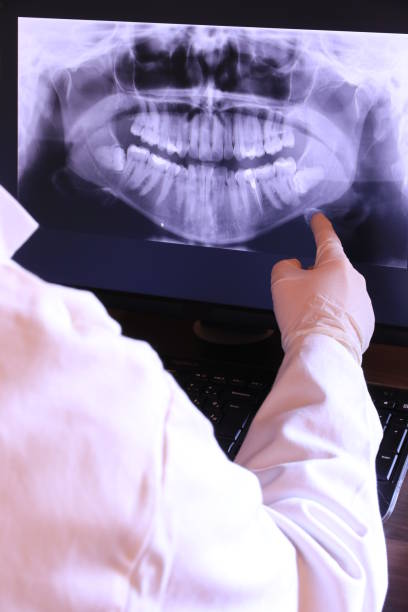 Best Emergency Tooth Extraction in Enon, VA