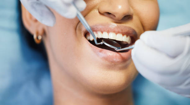 Best After-Hours Dental Trauma Care in Enon, VA