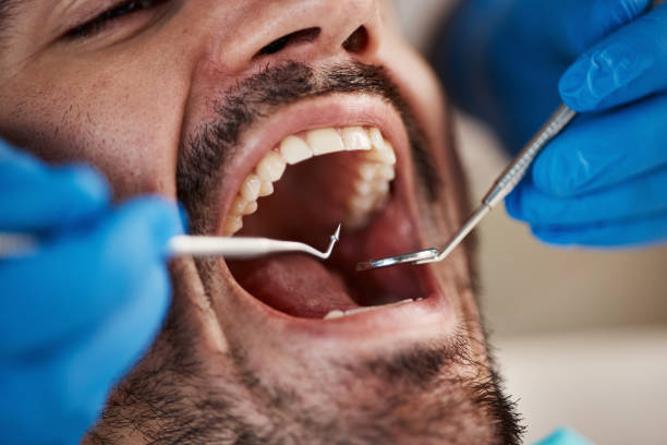 Best Emergency Treatment for Dental Infections or Abscesses in Enon, VA