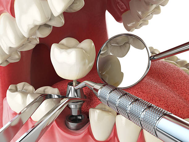 Best Cosmetic Emergency Dentistry in Enon, VA